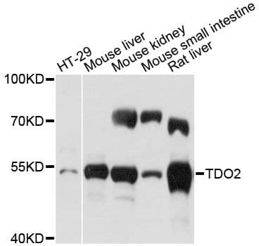 TDO2 Antibody