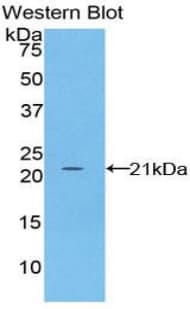 FBN1 / Fibrillin 1 Antibody (aa455-632, Cy3)