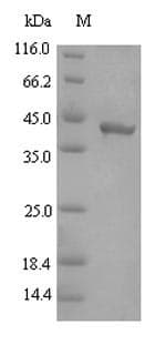 Porphyromonas gingivalis Gingipain R2 Protein (Recombinant 6His-SUMO, N-terminus)