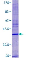Human VKORC1 Protein (Recombinant GST)