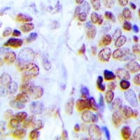 Polyclonal Rabbit anti-Human DKC1 / Dyskerin Antibody (Internal, IHC, IF, WB)