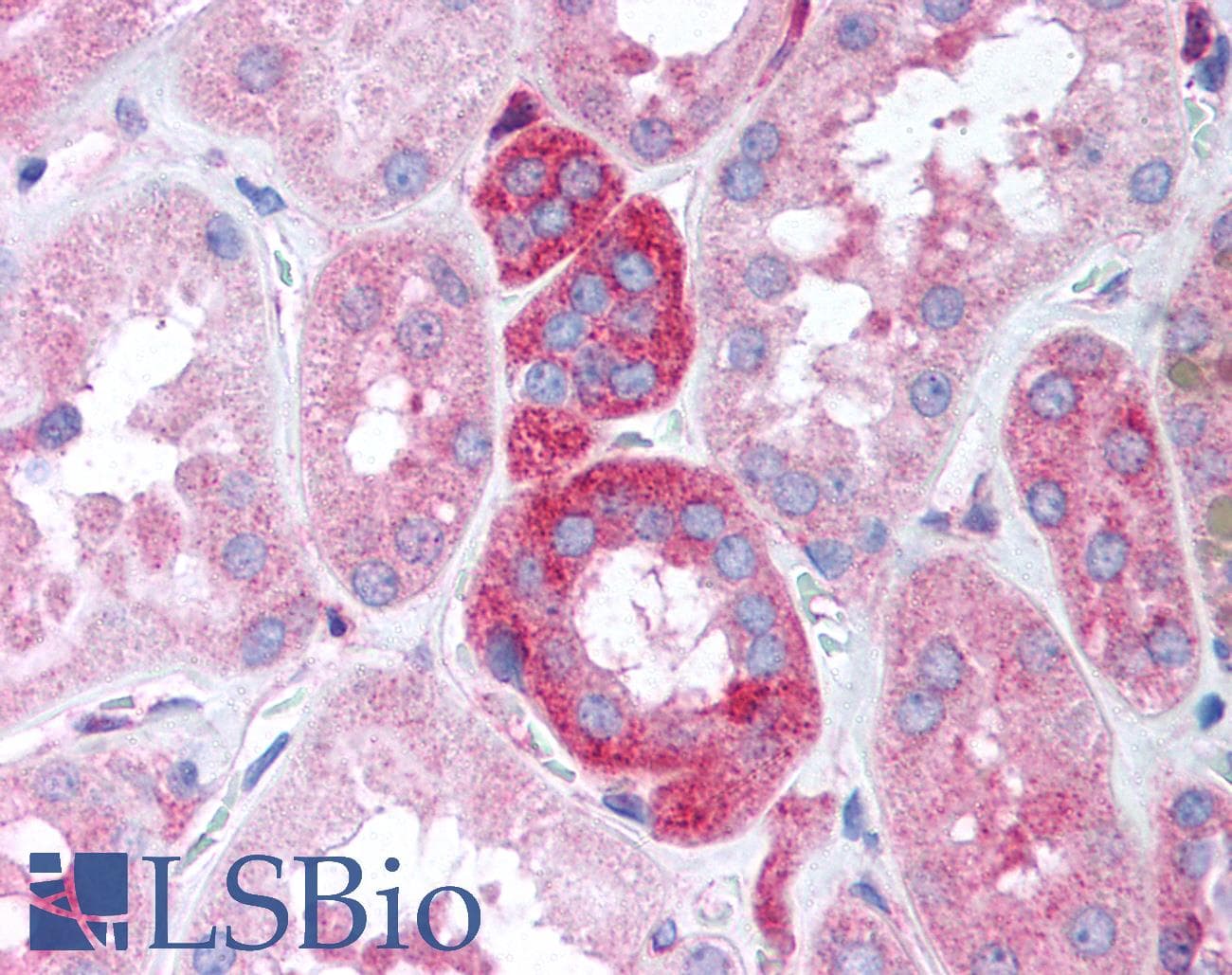 IHC-plus™ Polyclonal Rabbit anti-Human GB5 / GNB5 Antibody (IHC, WB)