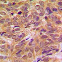 FOXO4 / AFX1 Antibody (phospho-Ser197)