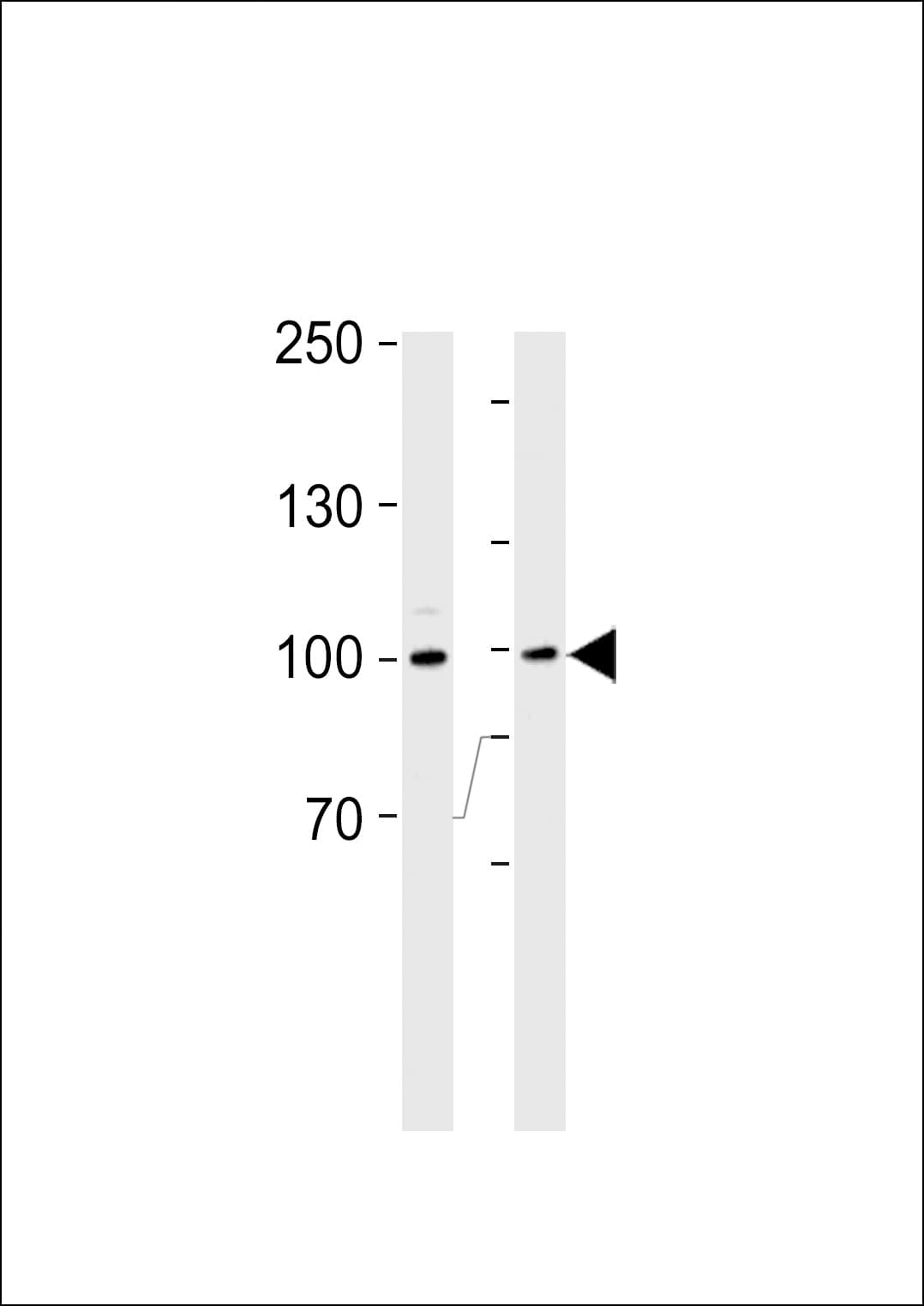 RPS6KA3 / RSK2 Antibody (aa13-42)
