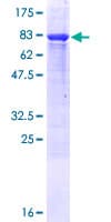 Human TBC1D22B Protein (Recombinant GST)