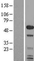 SMAP1 Protein (Over-Expression Lysate Myc-DDK (Flag))