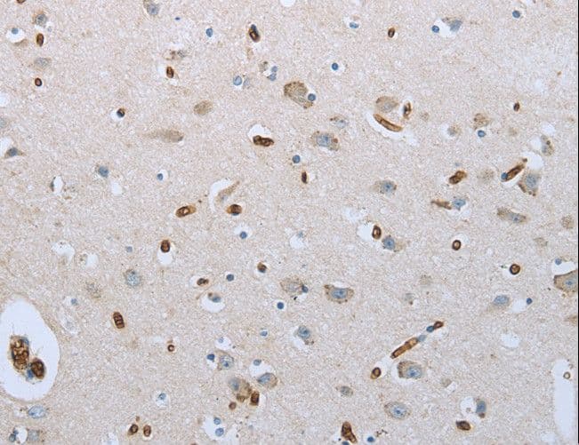 FGF1 / Acidic FGF Antibody