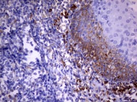 PIK3C2A Antibody (aa230-560, clone OTI3D1)