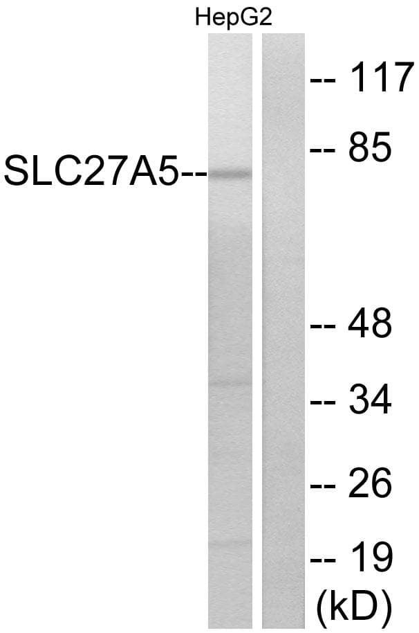 SLC27A5 / BACS Antibody
