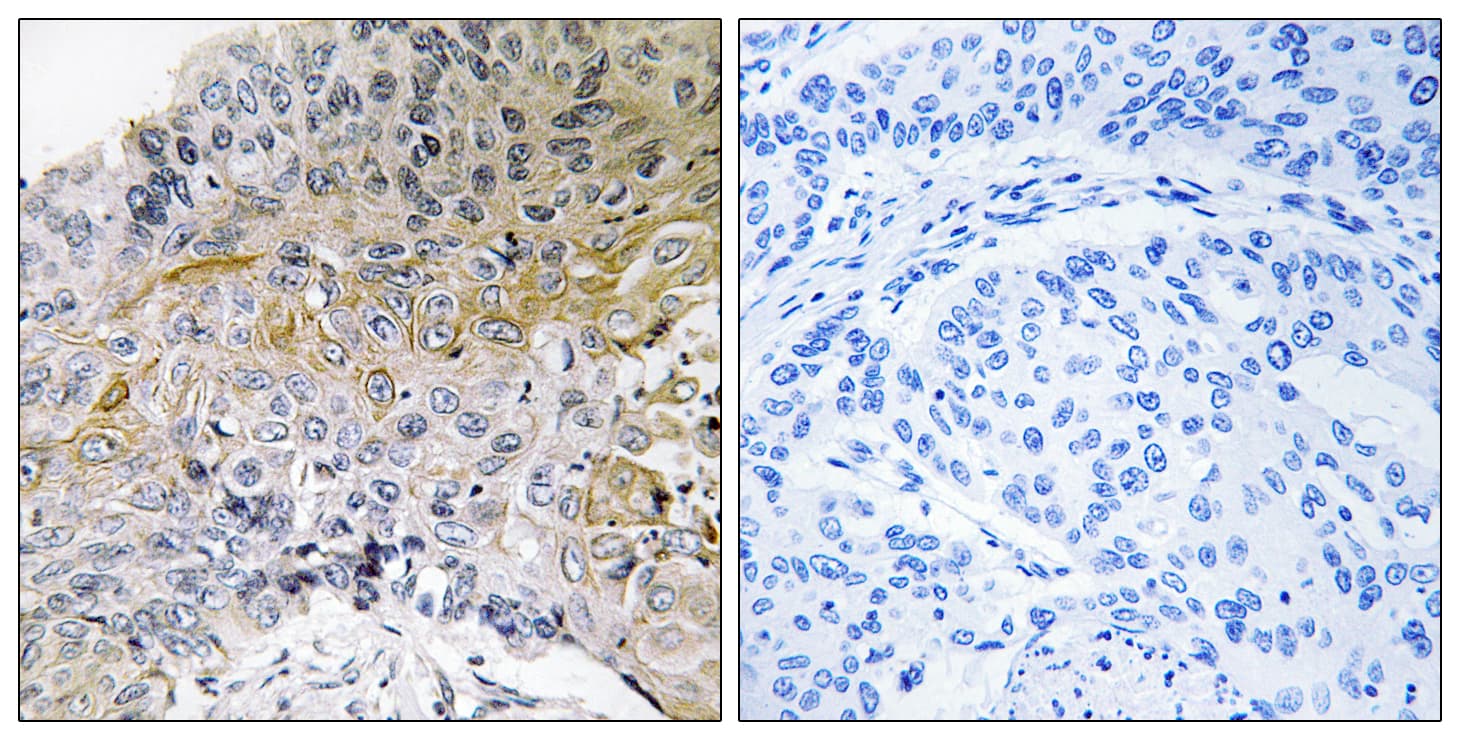 Polyclonal Rabbit anti-Human BCAR1 / p130Cas Antibody (aa376-425, IHC, WB)
