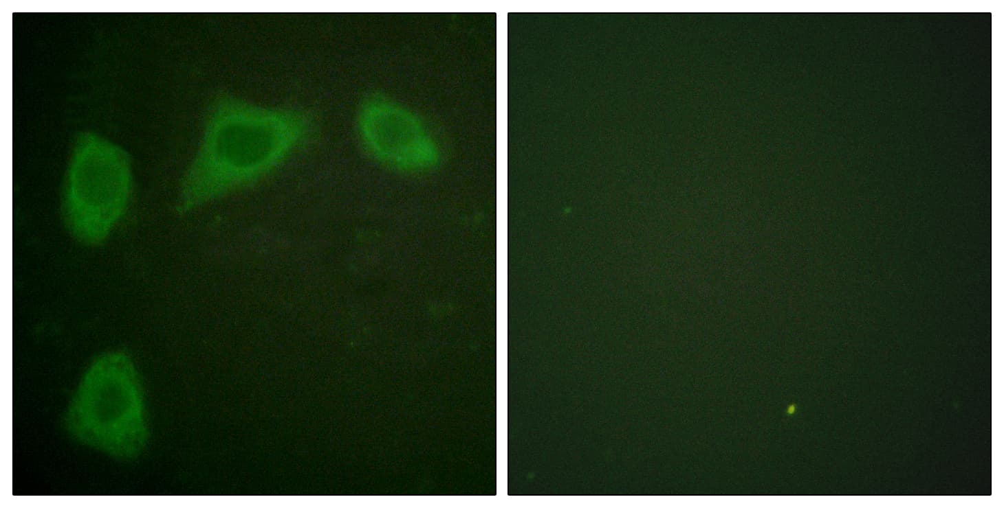 IHC-plus™ CAV1 / Caveolin 1 Antibody (aa129-178)
