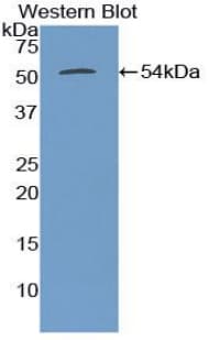 TUBB3 / Tubulin Beta 3 Antibody (aa222-438, APC)