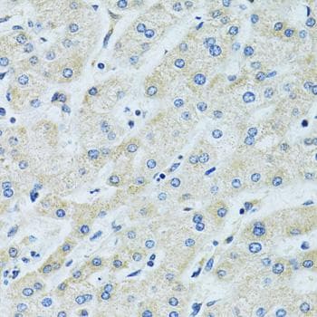 SLC5A6 / SMVT Antibody