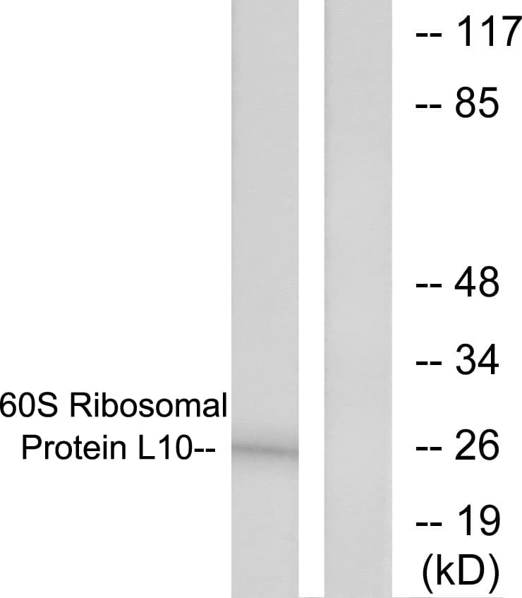 RPL10 / Ribosomal Protein L10 Antibody (aa1-50)