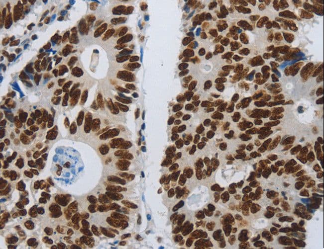 Polyclonal Rabbit anti-Human SLC16A14 / MCT14 Antibody (IHC)