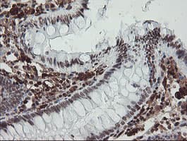 F13A1 / Factor XIIIa Antibody (clone 6F5, Carrier-free)