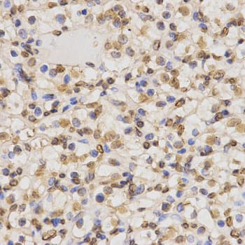 Histone H3 Antibody (Di-Methyl-Lys36)