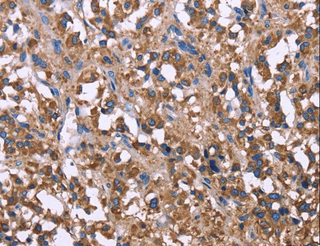 SERPINA1 / Alpha 1 Antitrypsin Antibody