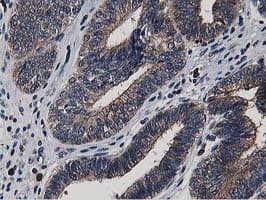 Monoclonal Mouse anti-Human ATG3 Antibody (clone OTI2C12, IHC, IF, WB)