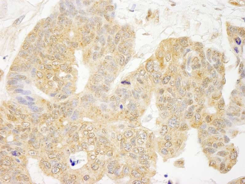 Polyclonal Rabbit anti-Human GRB10 Antibody (aa100-150, IHC)