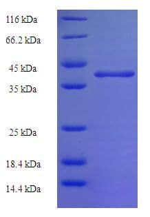 Human N6AMT2 Protein (Recombinant His-SUMO)