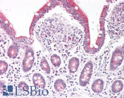 TP53INP2 Antibody