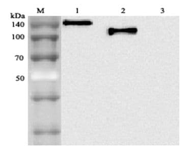 Monoclonal Mouse anti-Human ACE2 / ACE-2 Antibody (clone AC18F, IHC, WB)