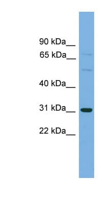 Polyclonal Rabbit anti-Human SLCO1B1 / OATP2 Antibody (C-Terminus, WB)