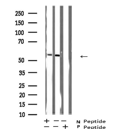 p56lck / LCK Antibody (phospho-Ser59)