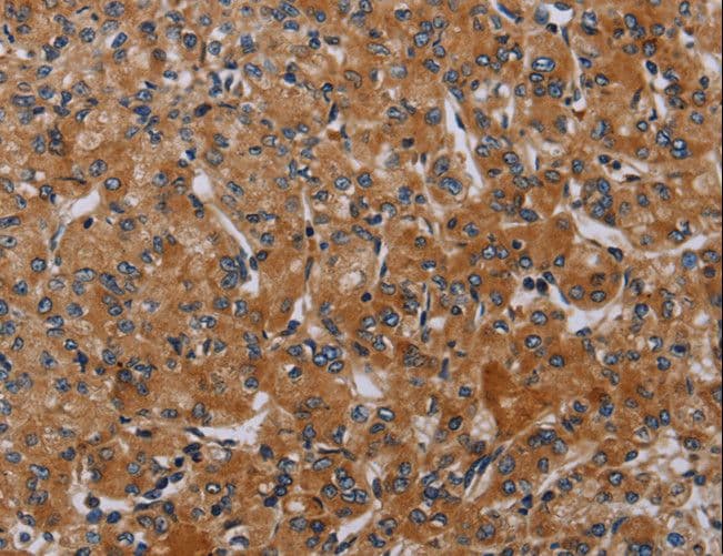 Polyclonal Rabbit anti-Human P2RY2 / P2Y2 Antibody (IHC)