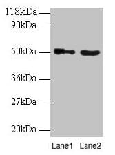 IHC-plus™ VOPP1 / ECOP Antibody