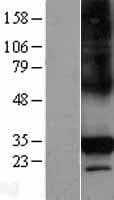 C1QTNF6 / CTRP6 Protein (Over-Expression Lysate Myc-DDK (Flag))