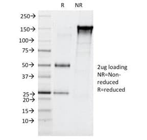 CELA3B / ELA3B Antibody (clone CELA3B/1257)