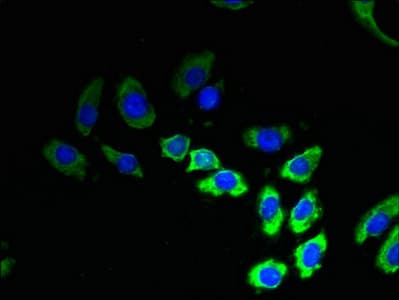 Polyclonal Rabbit anti-Human TMEM53 Antibody (IHC, WB)