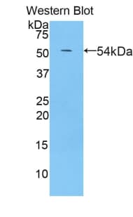 PZP Antibody (aa1251-1500)