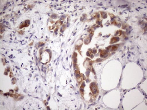 SSX2IP Antibody (aa1-272, clone OTI5C3)