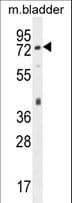 PECAM-1 / CD31 Antibody (aa508-536)