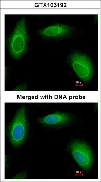 RANBP1 Antibody (aa1-201)
