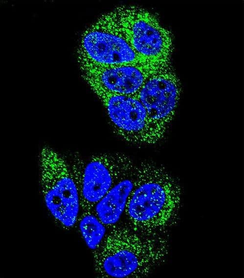 HNF4A / HNF4 Antibody (aa107-139)