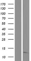 MRPL22 Protein (Over-Expression Lysate Myc-DDK (Flag))