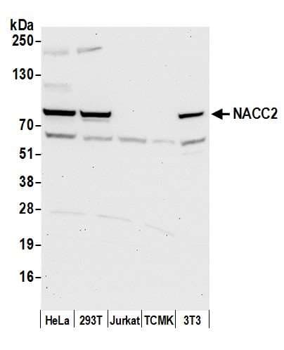 NACC2 / BTBD14A Antibody (aa175-225)