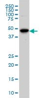 AURKA / Aurora-A Antibody (aa1-111, clone 5F8)