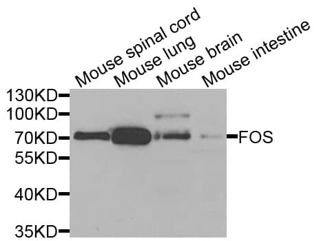 FOS / c-FOS Antibody