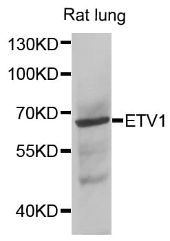 ER81 / ETV1 Antibody