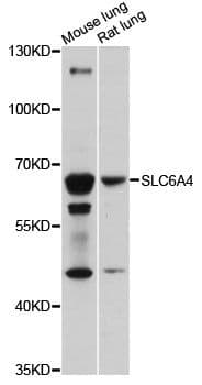 SLC6A4 / SERT Antibody