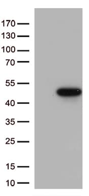 MAPK14 / p38 Antibody (aa2-360, clone OTI3F8)