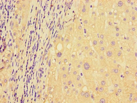 DDIT4 / REDD1 Antibody