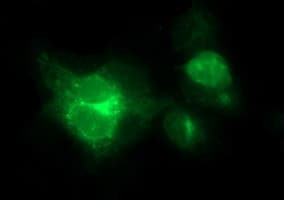 MFAP3 Antibody (clone OTI1G1)