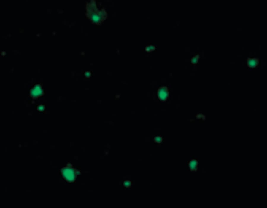 Polyclonal Rabbit anti-Human ACIN1 / Acinus Antibody (IF, WB)