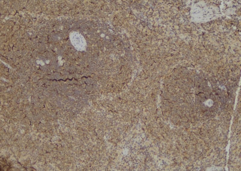 CASP9 / Caspase 9 Antibody